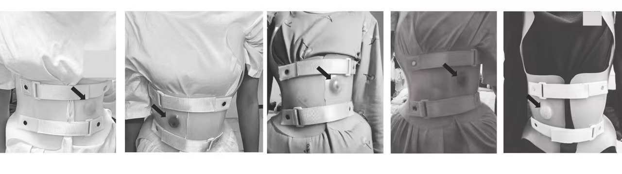 BraceSense practical 3